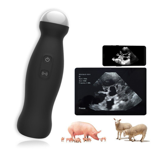 Wireless ultrasound machine - wireless,