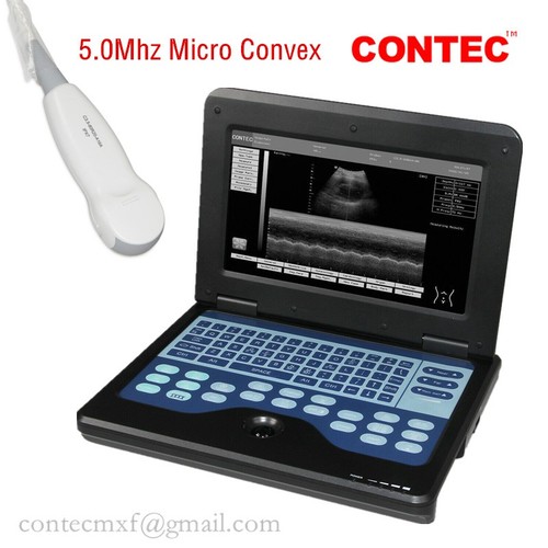 Cms600p2 portable ultrasound - portable,