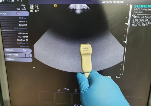 Siemens acuson 10v4 ultrasound - siemens,