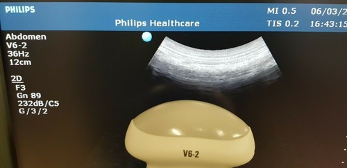 Philips convex 4d - v6-2,
